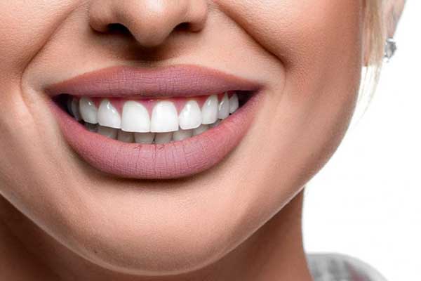 ابتسامة هوليود في بورصة - إنغول تركيا